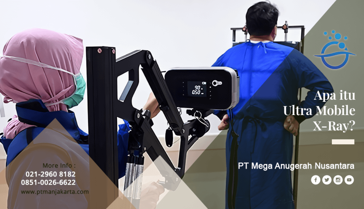 artikel apa itu ultra mobil xray revisi