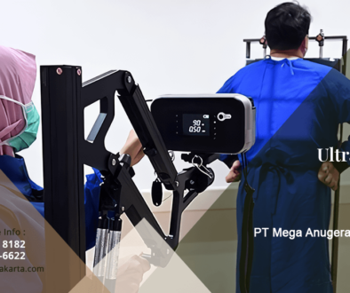 artikel apa itu ultra mobil xray revisi